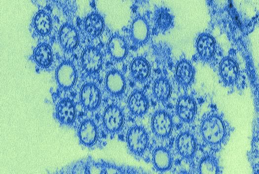 H1N1 micrograph
